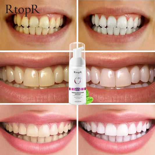 Tooth Whitening Mousse – the ultimate solution for a brighter, healthier mouth.